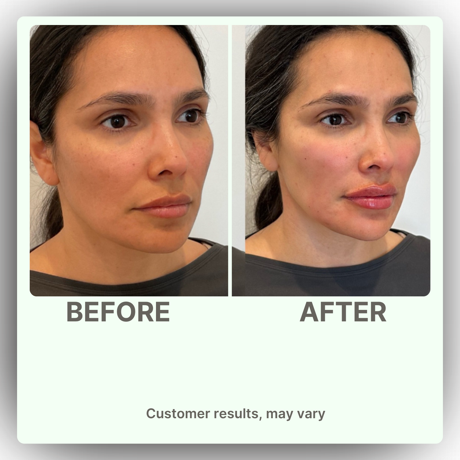 Nature's Sunshine Lymphatic Drainage